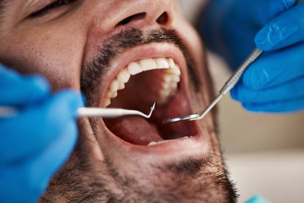 Best Broken or Chipped Tooth Repair in Lockhart, TX